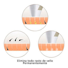 Depiladora De Vello Laser Permanente Kemei Km-6812
